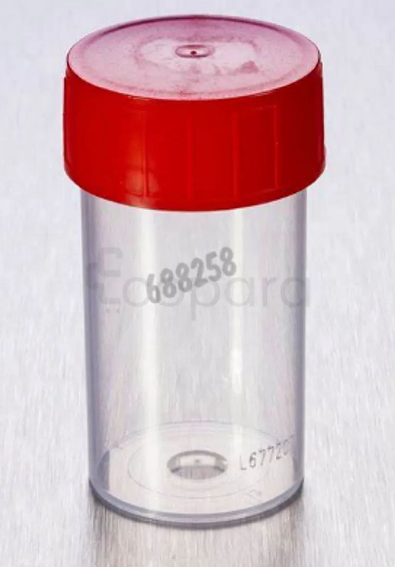 Conteneurs d'échantillons.