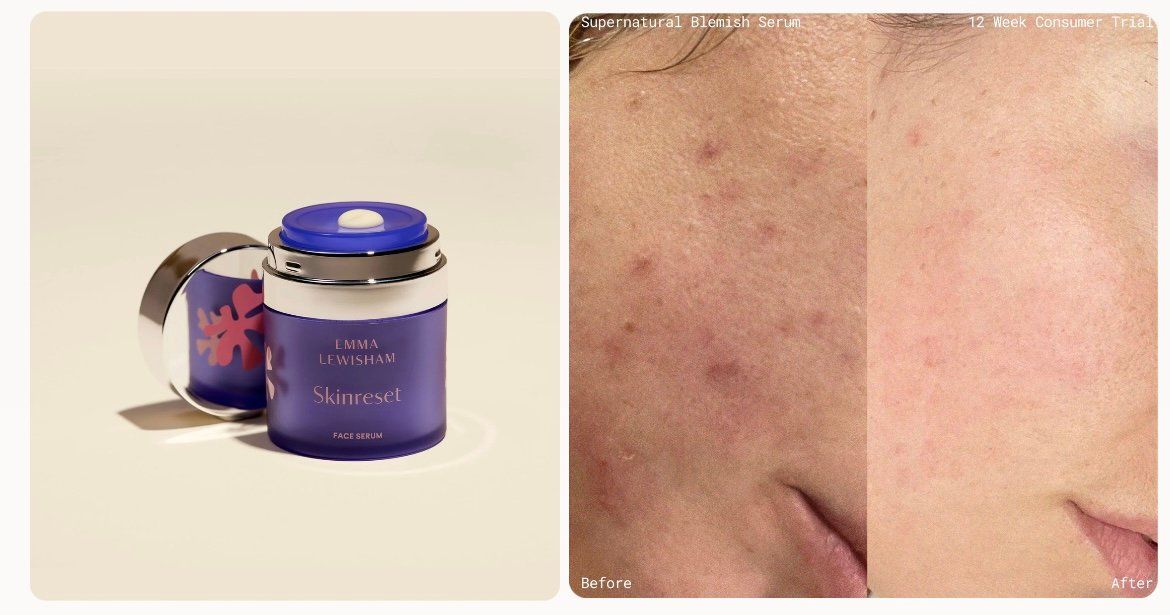 შრატი, ტონერი, ნიღაბი და სხვა