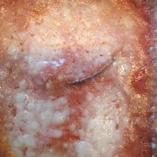Parmigiana