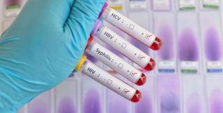 Análise Hepatites, HIV e Sifílis