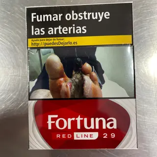 Fortuna 29