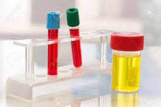  Análises de sangue ou Urina com prescrição médica