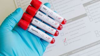 Consulta sobre Enfermedades Sexuales. Transmisión y tratamientos. 