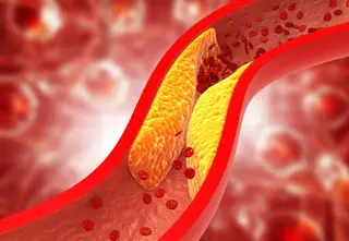 Lipid Profile Analysis