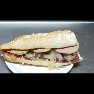 Foie Con Jamón Serrano Y Cebolla A La Plancha