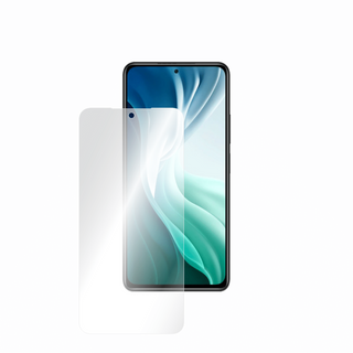 Folie  Xiaomi Mi 11i - Doar-Display